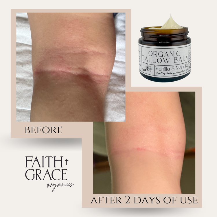 Organic Tallow Balm - Vanilla & Manuka