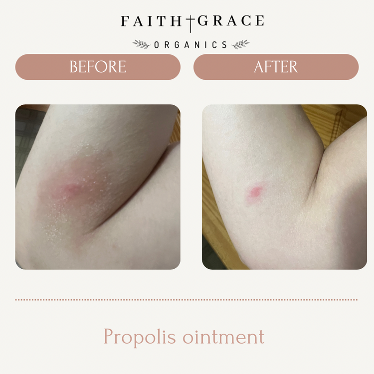 Propolis Healing Ointment